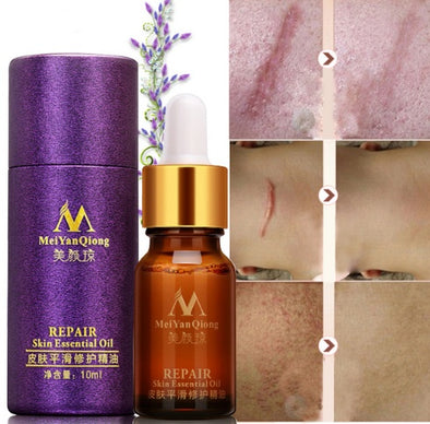 Scar Skin Repair Essential Oil Lavender Care Natural Skin Pure Remove Ance Burn Stretch Marks Removal Scar 10 МЛ