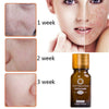 Dredge Meridian Skin Care Natural Pure Removal Acne Stretch Marks Scar Removal Essence oil