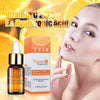 Vitamin C Serum VC Entfernen Dunkle Flecken Sommersprossen Speckle Verblassen Zeitlose Hautpflege Aufhellung Gesicht Anti Winkles Essence Schönheit