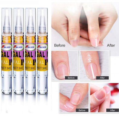 Nail Treatment Fluid Nail Fungus Treatment