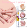 Nail Treatment Fluid Nail Fungus Treatment